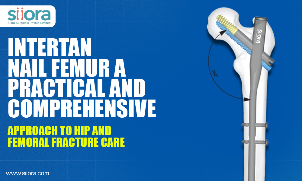 Intertan Nail Femur: A Practical and Comprehensive Approach to Hip and Femoral Fracture&nbsp;Care